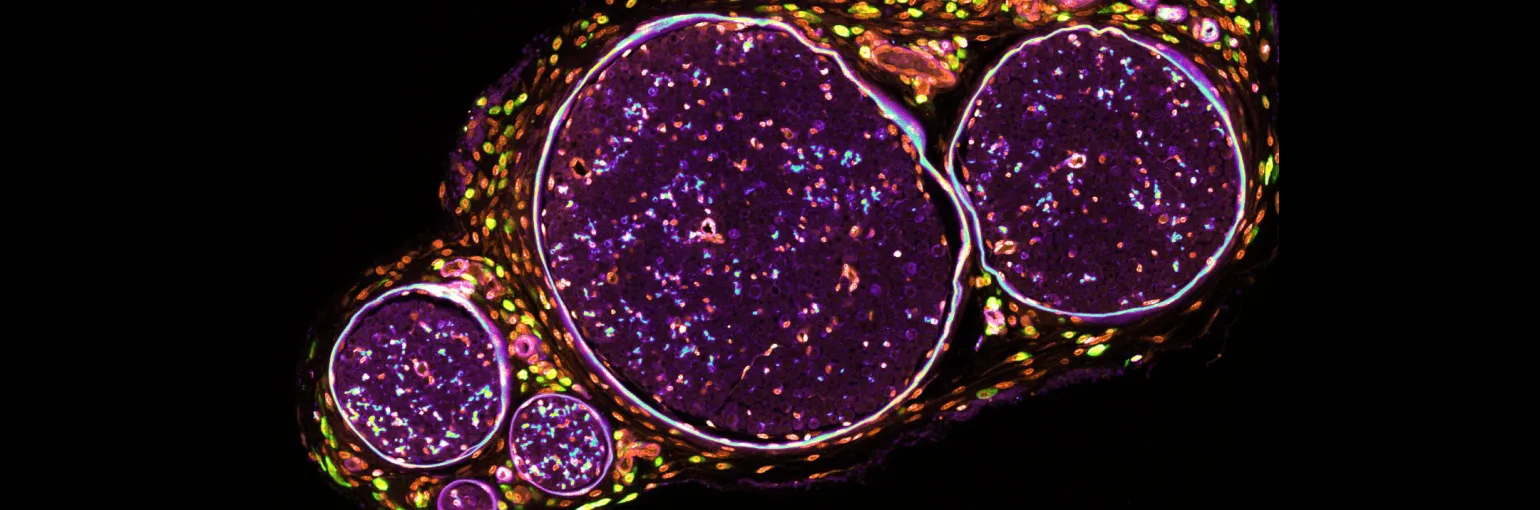 Macrophage